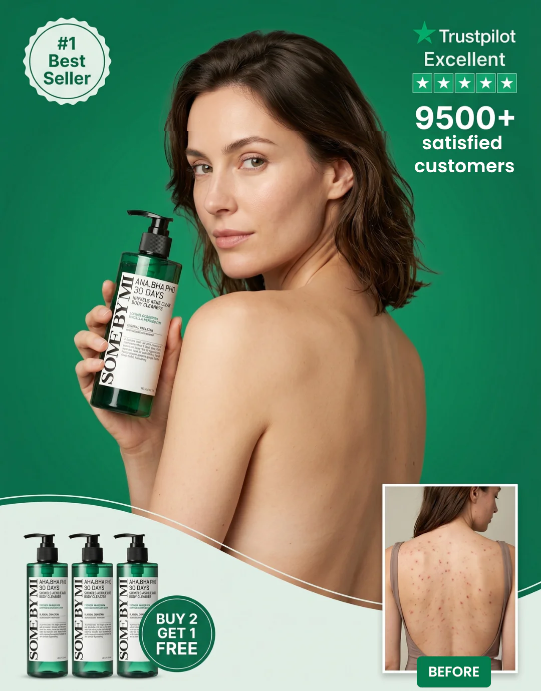 Clear Acne In 14 Days